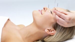 Akupunktura kosmetyczna odmlodzenie skory zabiegi na cialo Medycyna estetyczna zabiegi cena
